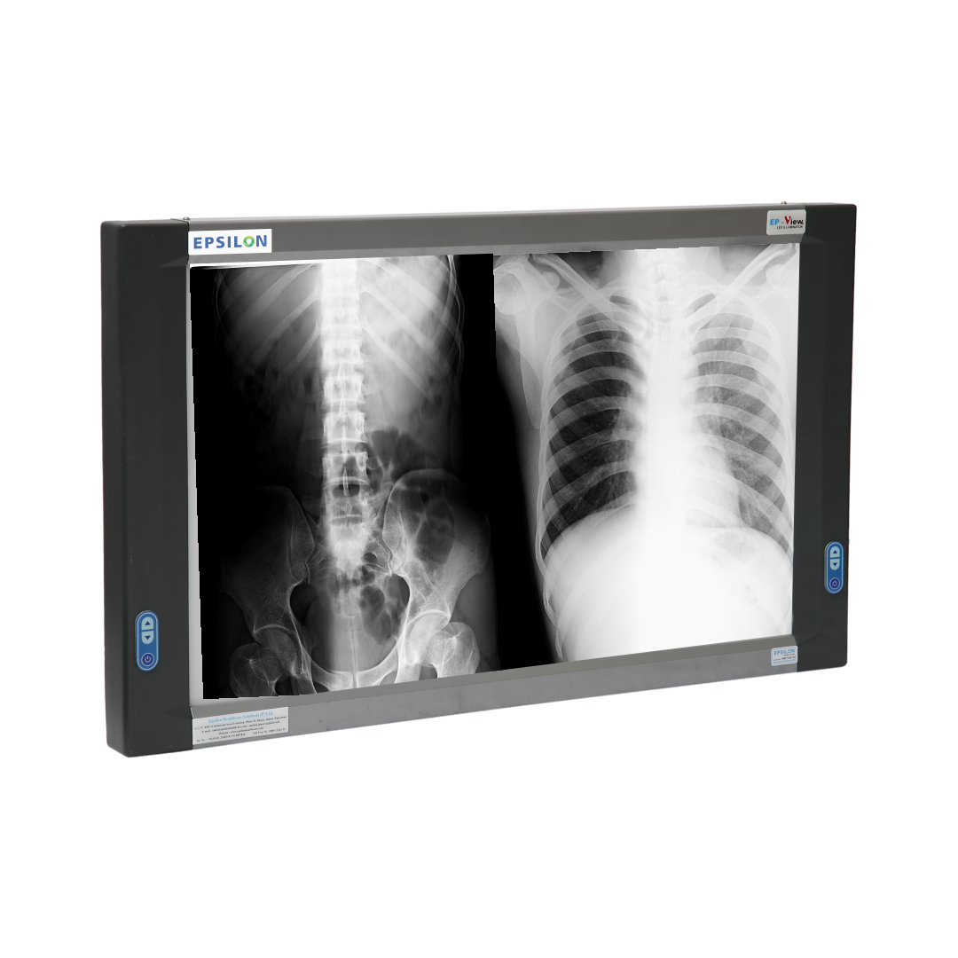 X-Ray Fim viewer (View Box) Double